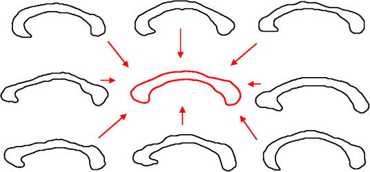 corpus callosum mean shape