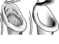 Isenberg et al., 2006